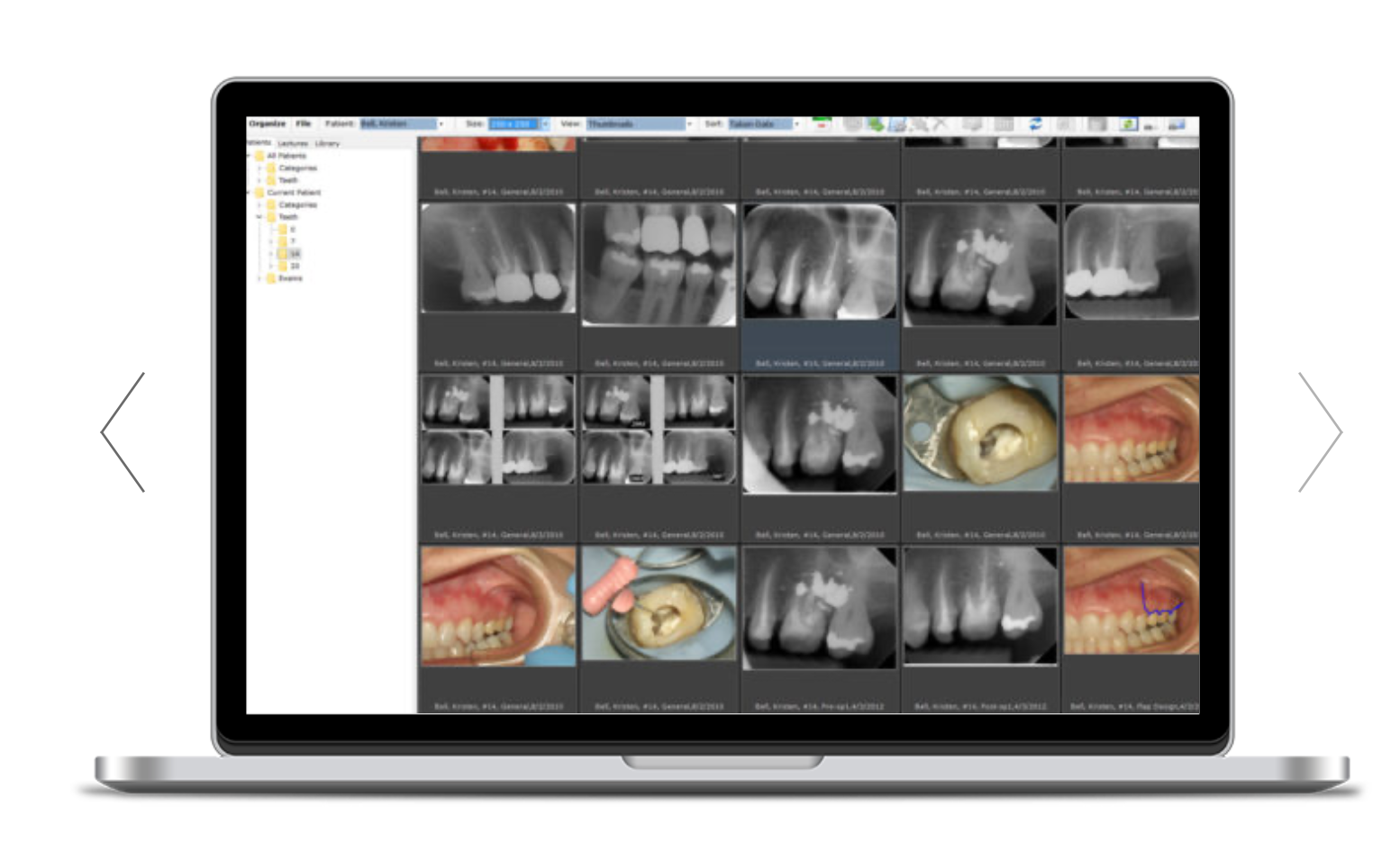Practice Management Software TDO (The Digital Software for Endodontists)